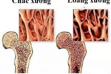 95 tuổi xương chắc hơn cả người độ tuổi 60, GS Đông y nổi tiếng chia sẻ 3 bí quyết